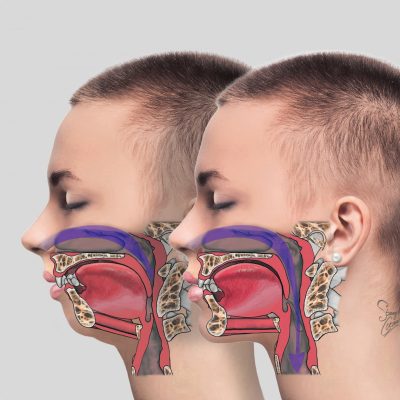 cirugia-maxillofacial.jpg